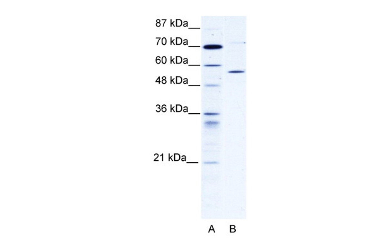 Antibody used in WB on Human 293T.