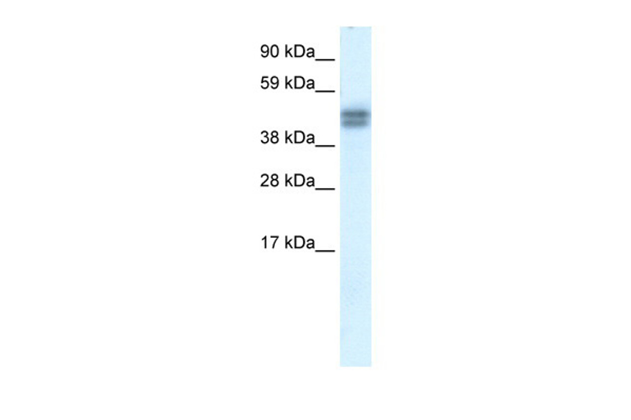 Antibody used in WB on Human Placenta at 0.2-1 ug/ml.