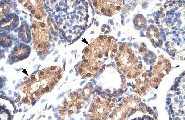 Antibody used in IHC on Human kidney.