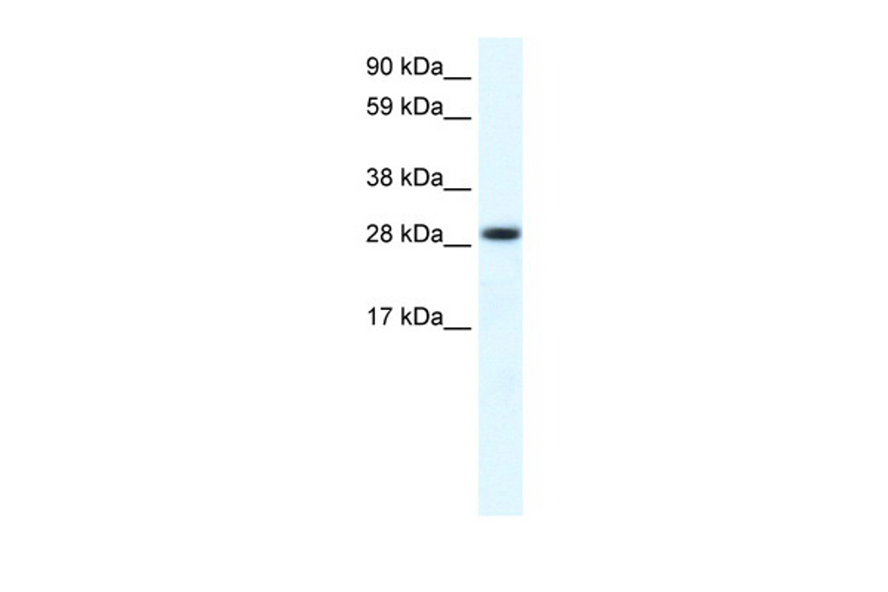 Antibody used in WB on Human Muscle at 0.1 ug/ml.
