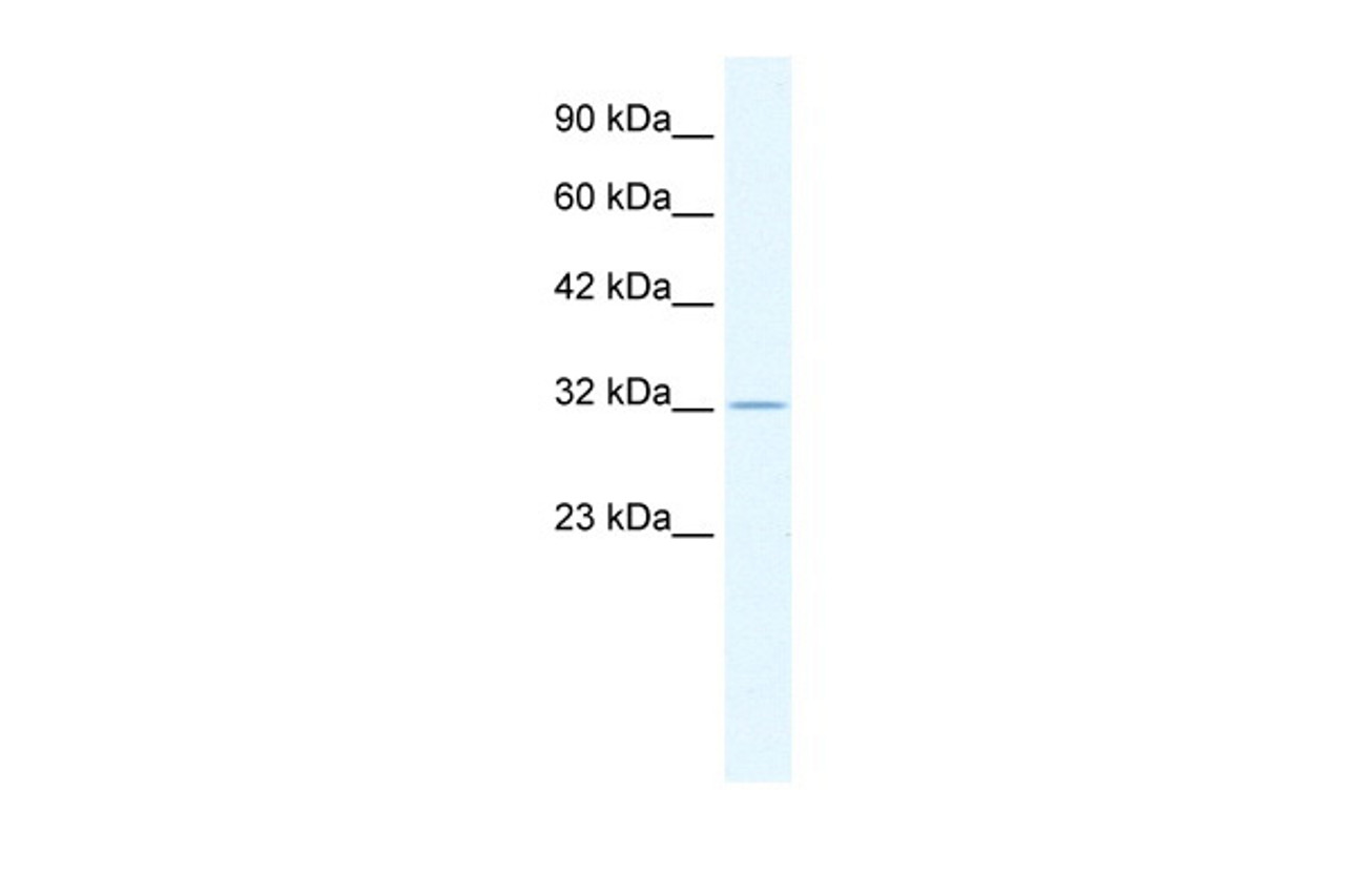 Antibody used in WB on Human HepG2 at 0.2-1 ug/ml.