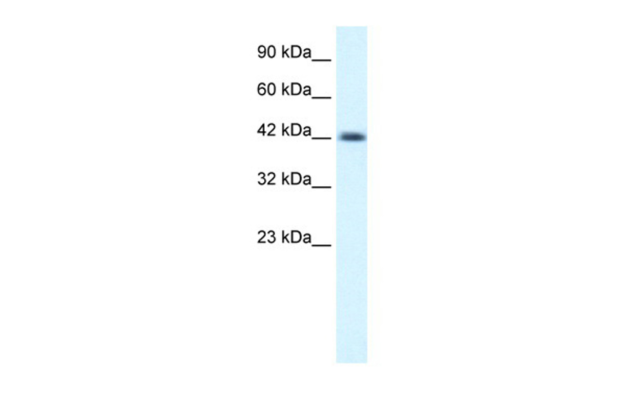 Antibody used in WB on Human Jurkat cells at 0.2-1 ug/ml.