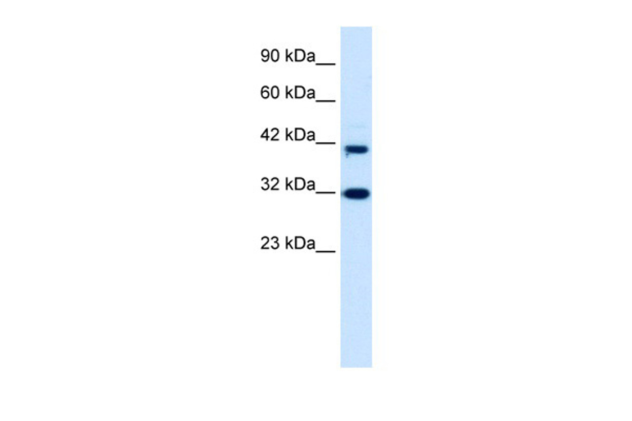 Antibody used in WB on Human HepG2 at 0.2-1 ug/ml.