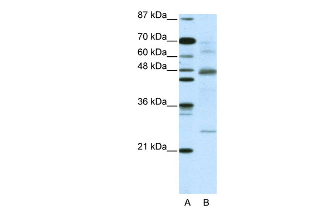 Antibody used in WB on Human Jurkat cells at 5.0 ug/ml.
