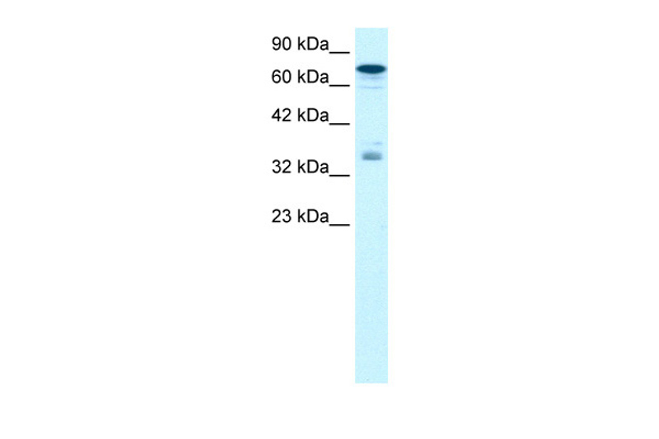 Antibody used in WB on Human HepG2 at 1.25 ug/ml.