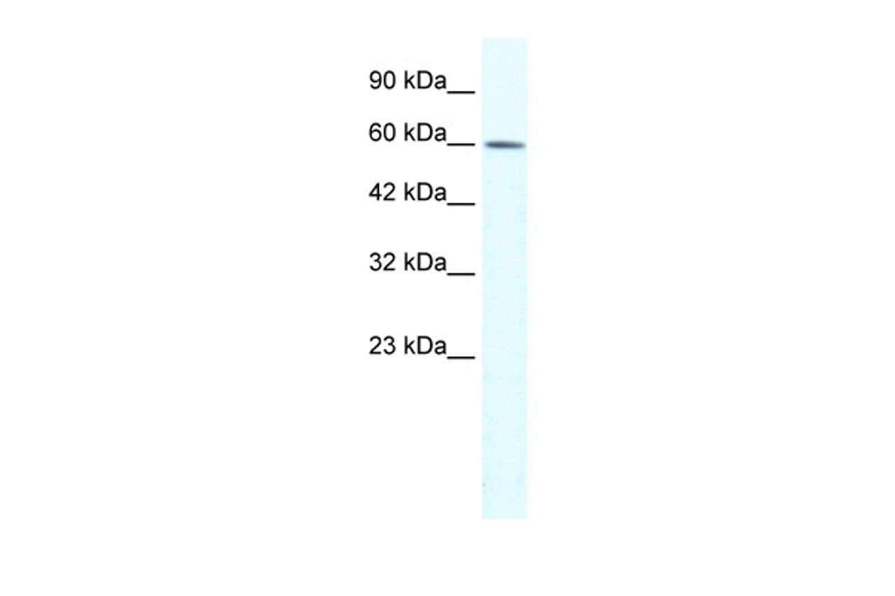 Antibody used in WB on Human HepG2 at 1 ug/ml.