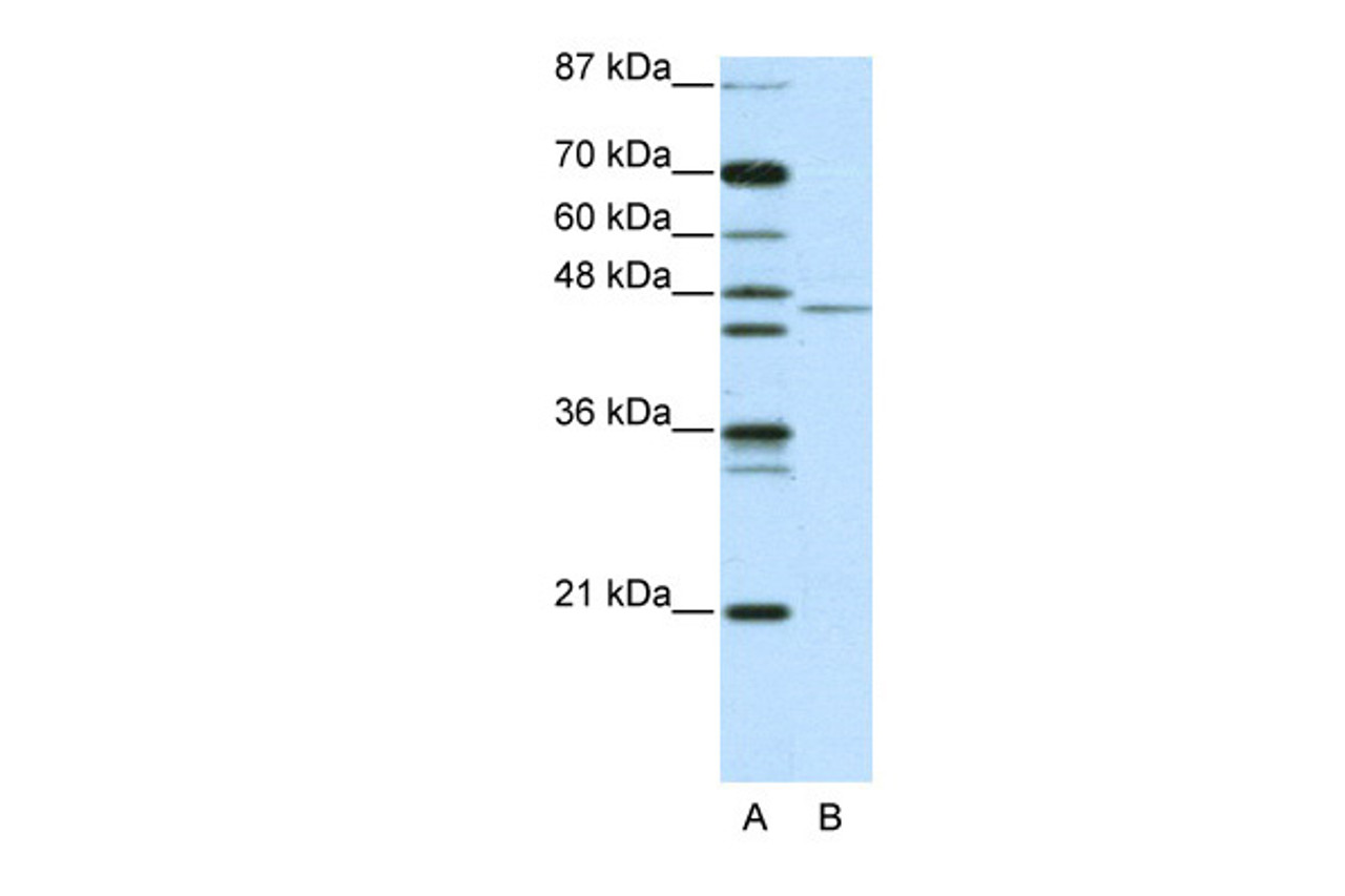 Antibody used in WB on Human Jurkat cells at 2.5 ug/ml.