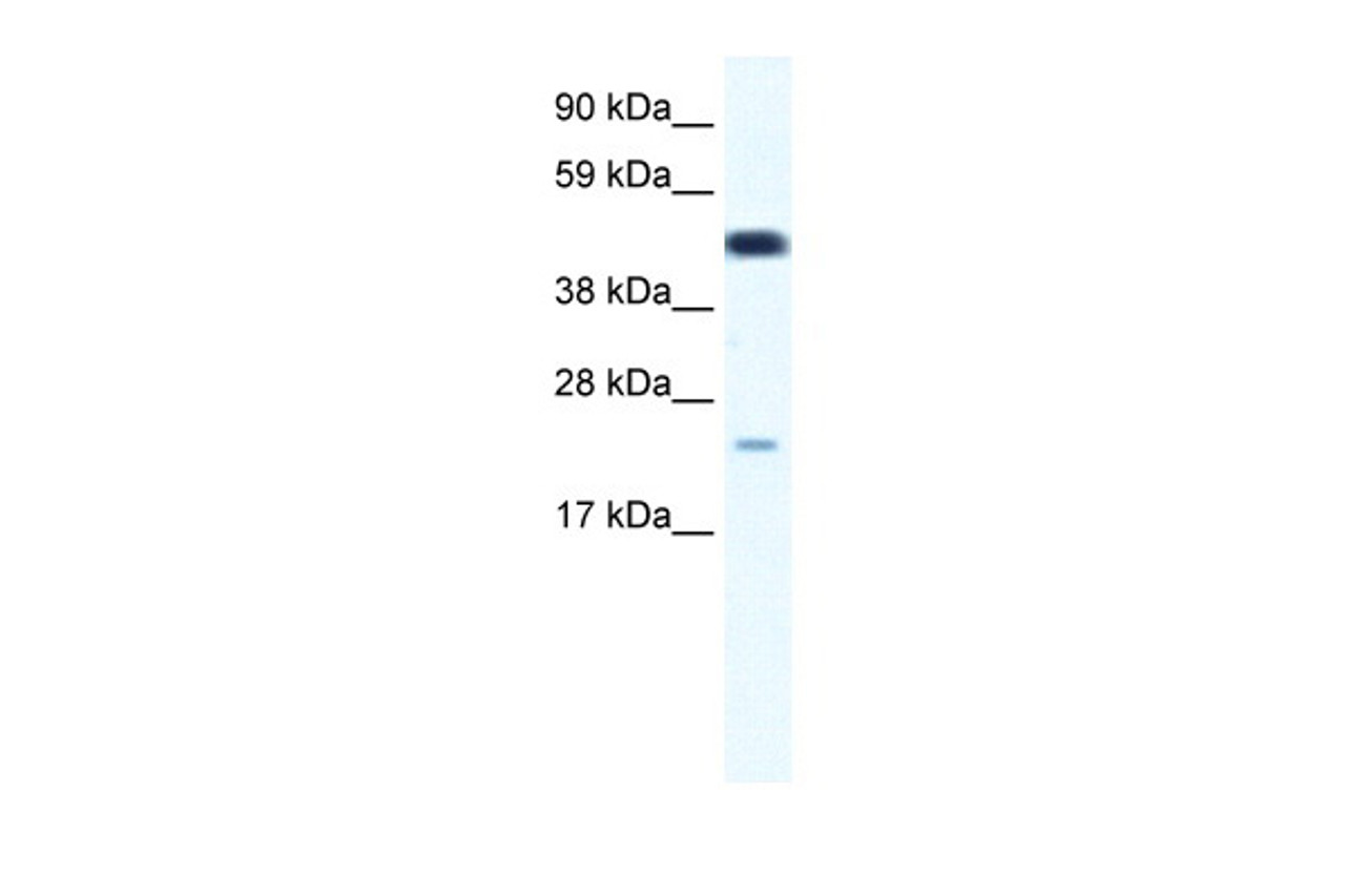 Antibody used in WB on Human Thymus at 0.125 ug/ml.