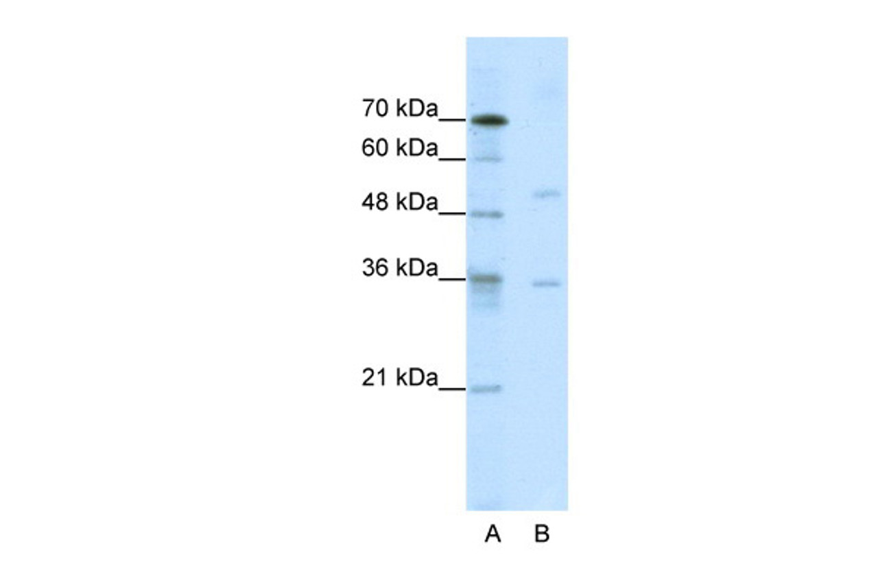 Antibody used in WB on Human Jurkat cells at 0.2-1 ug/ml.