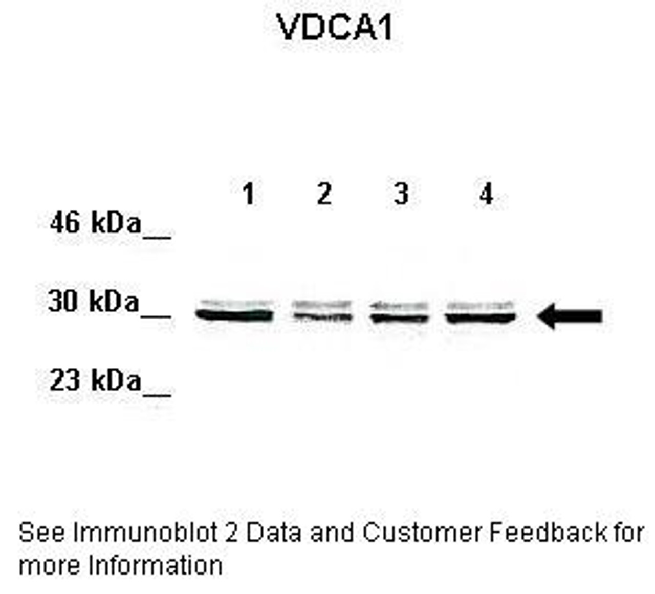 Antibody used in WB on Human cell lines at: 1:1000 (Lane 1: 50ug HeLa lysate, Lane 2: 50ug 293T lysate, Lane 3: 50ug K562 lysate, Lane 4: 50ug MDA-MB-231 lysate) .