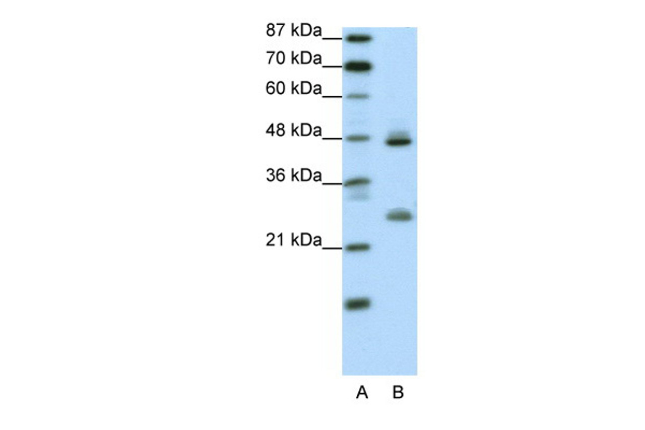 Antibody used in WB on Transfected 293T at 0.2-1 ug/ml.