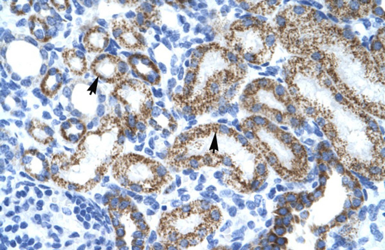 Antibody used in IHC on Human kidney.