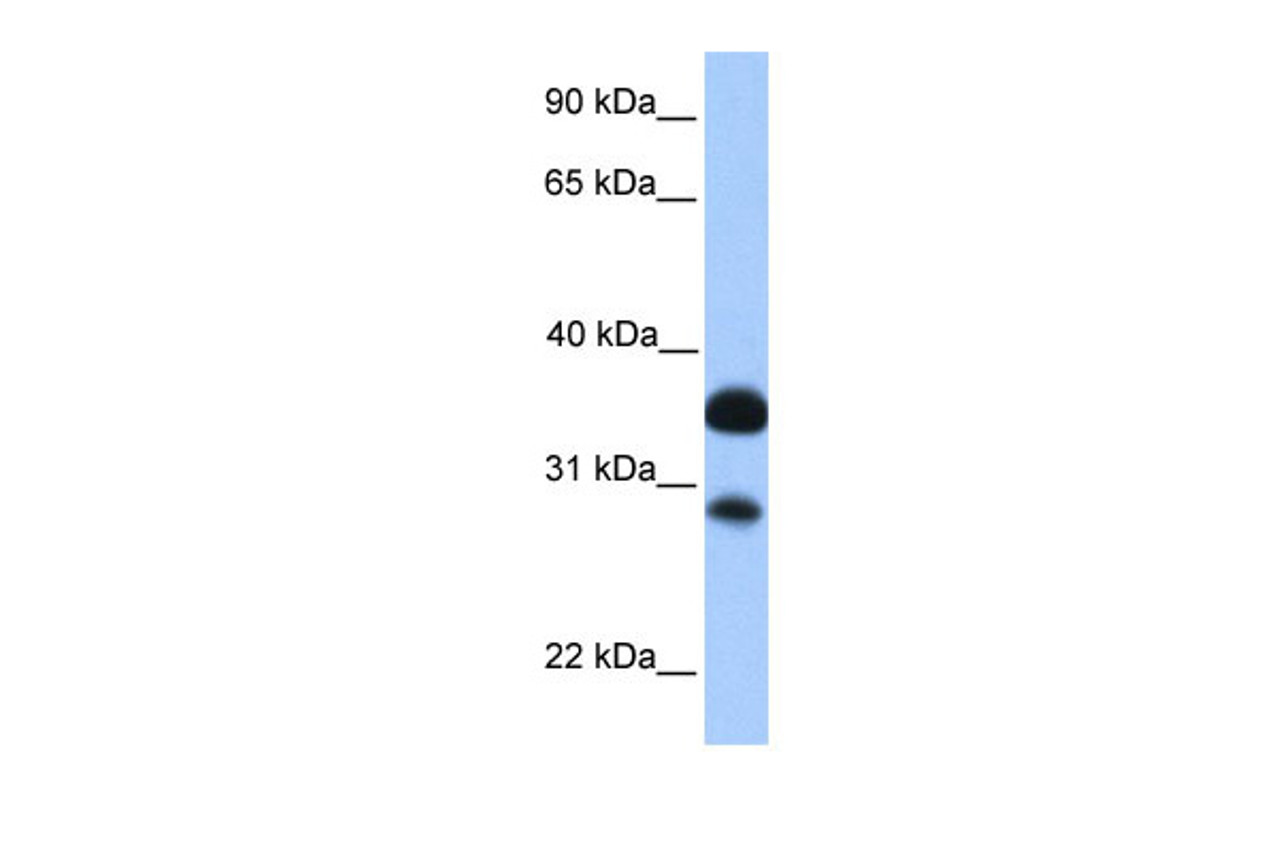 Antibody used in WB on Human Brain at 0.2-1 ug/ml.