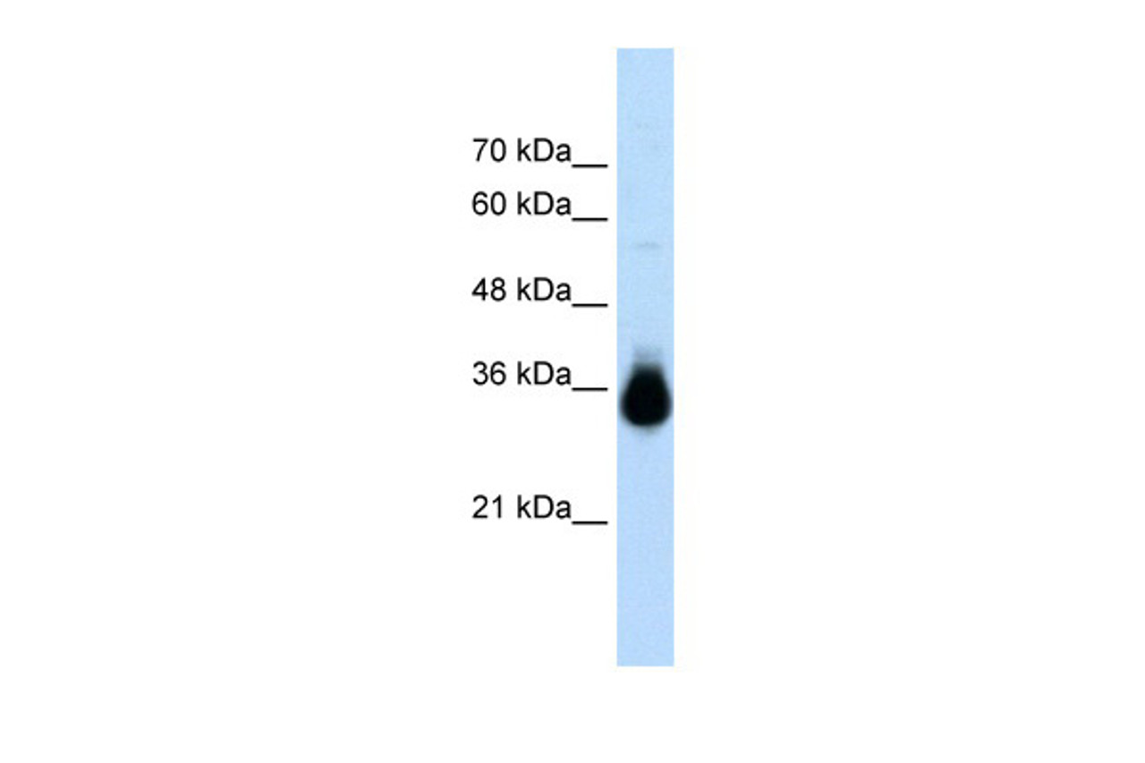 Antibody used in WB on Transfected 293T at 2.5 ug/ml.