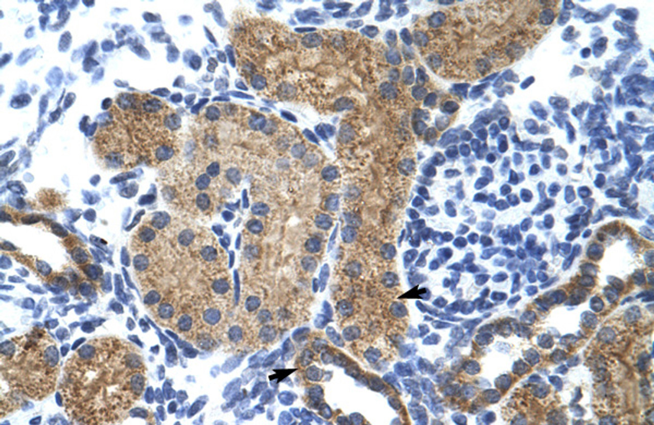 Antibody used in IHC on Human kidney.