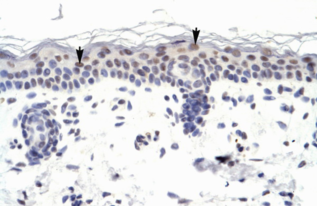 Antibody used in IHC on Human Skin.