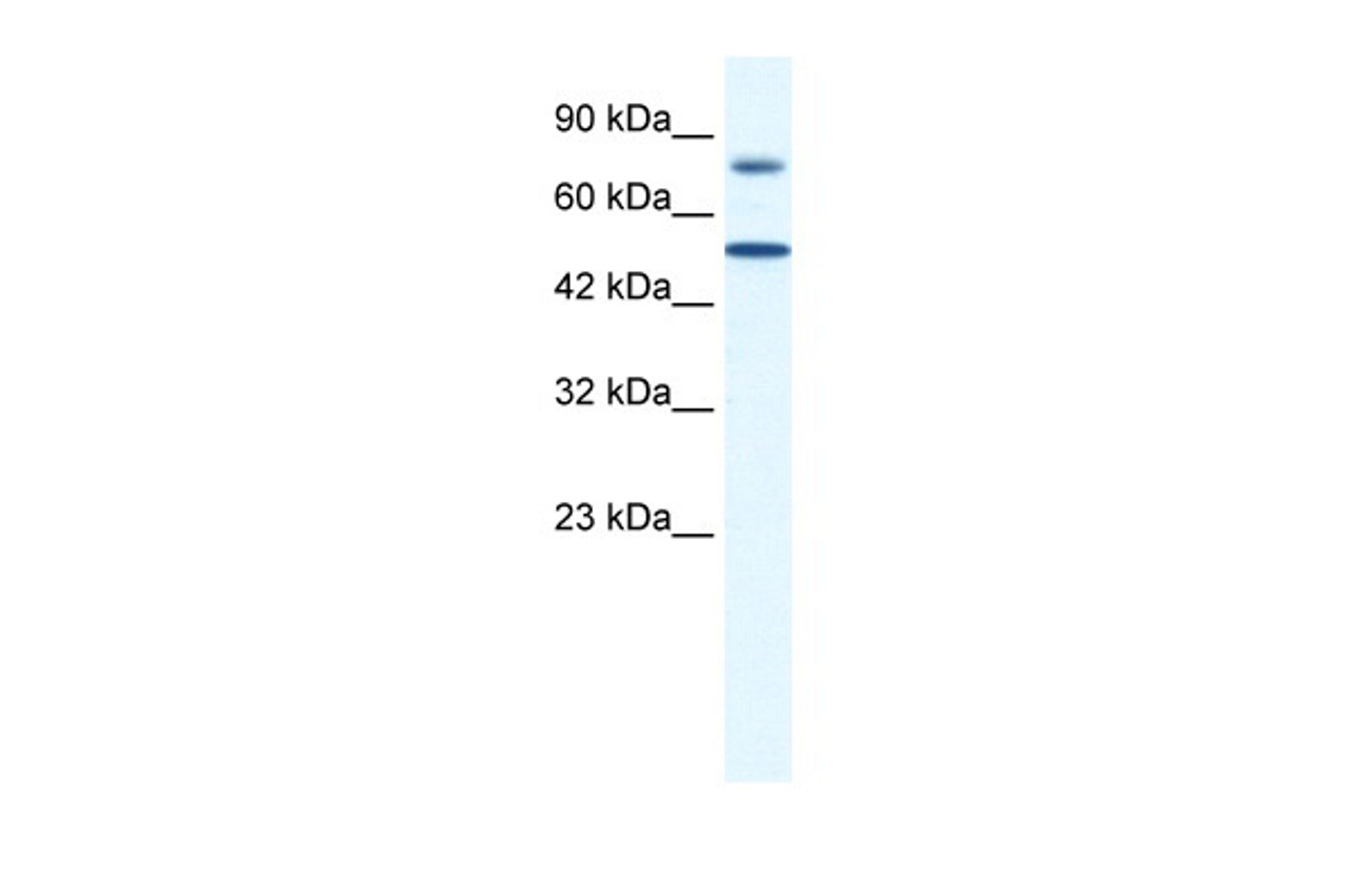 Antibody used in WB on Human Jurkat 0.2-1 ug/ml.