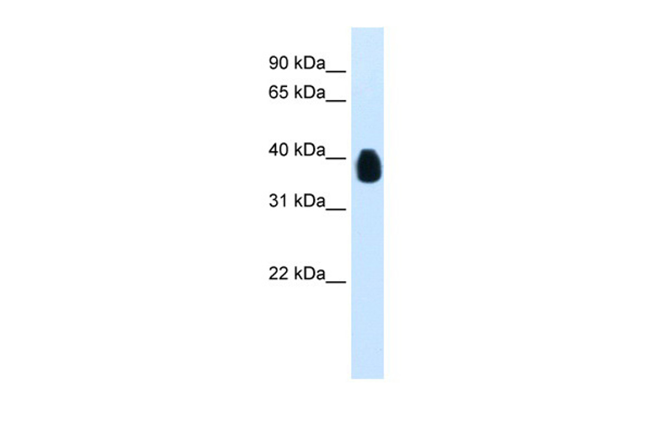 Antibody used in WB on Transfected 293T at 0.0625 ug/ml.