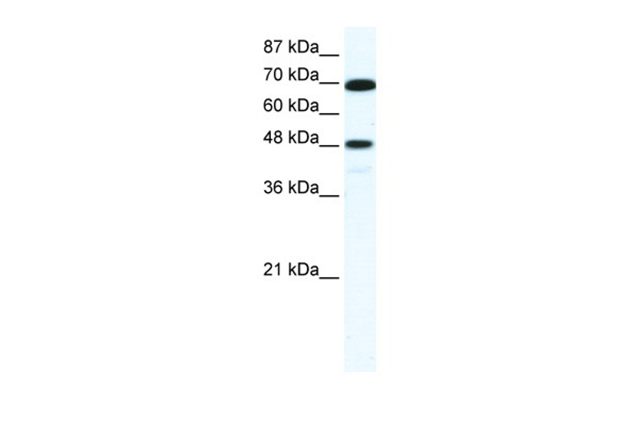 Antibody used in WB on Human Jurkat 5.0 ug/ml.