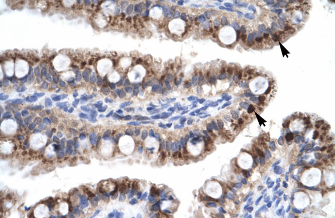 Antibody used in IHC on Human Intestine.