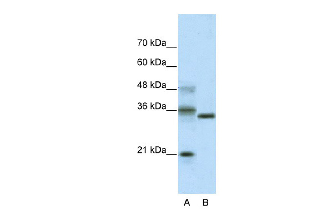 Antibody used in WB on Transfected 293T at 5.0 ug/ml.