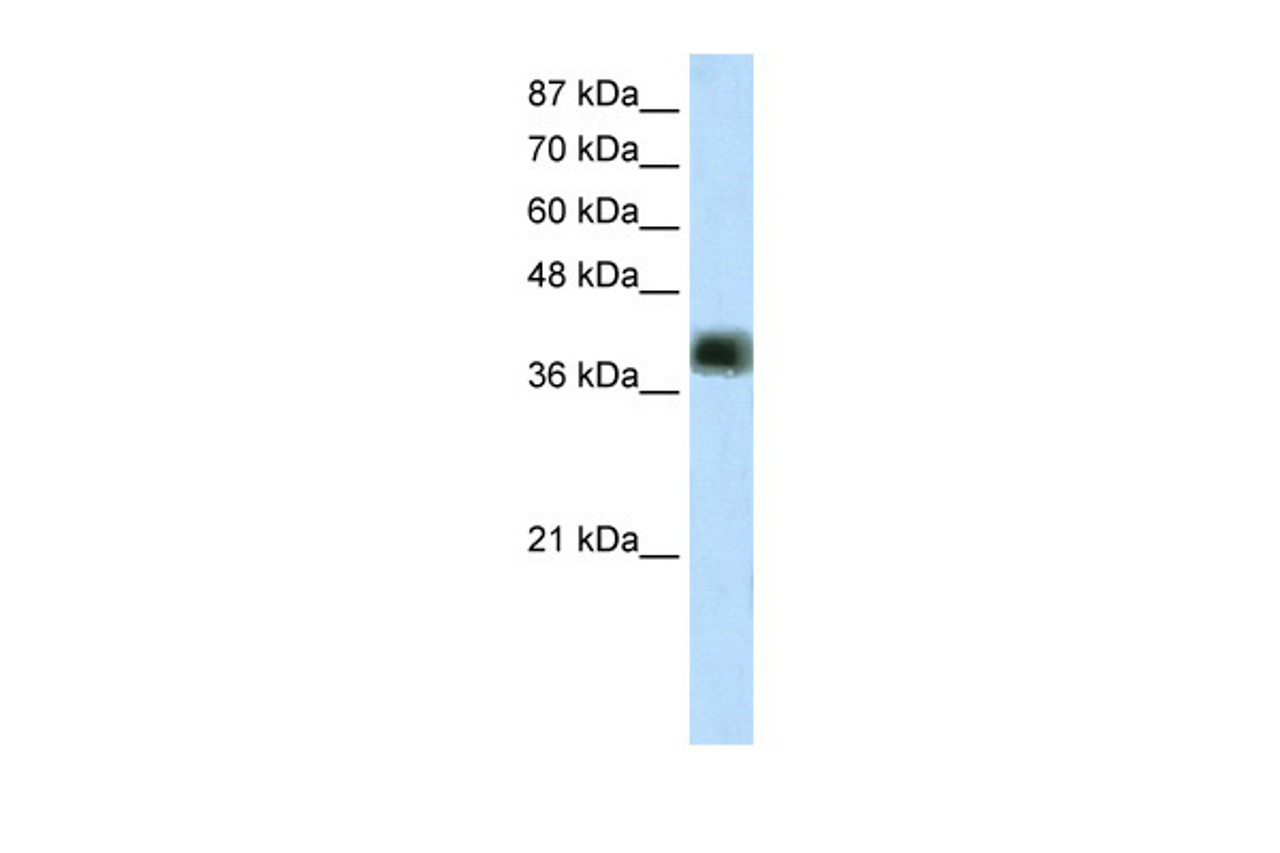 Antibody used in WB on Transfected 293T at 2.5 ug/ml.