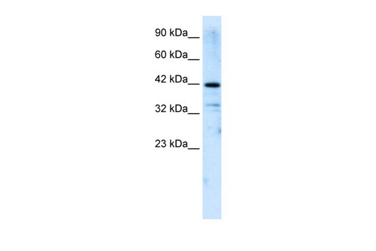 Antibody used in WB on Human Jurkat 2.5 ug/ml.