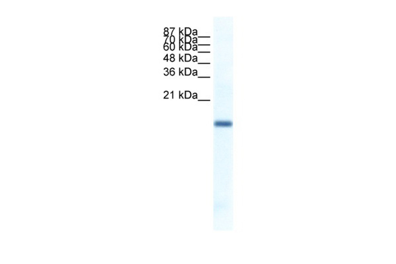 Antibody used in WB on Human Jurkat 1 ug/ml.