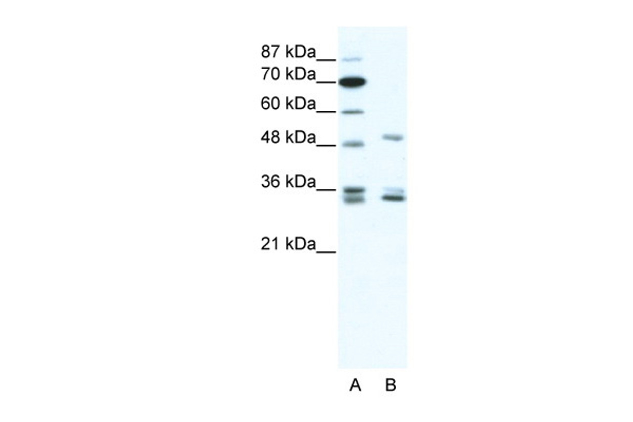 Antibody used in WB on Human HepG2 at 1.25 ug/ml.