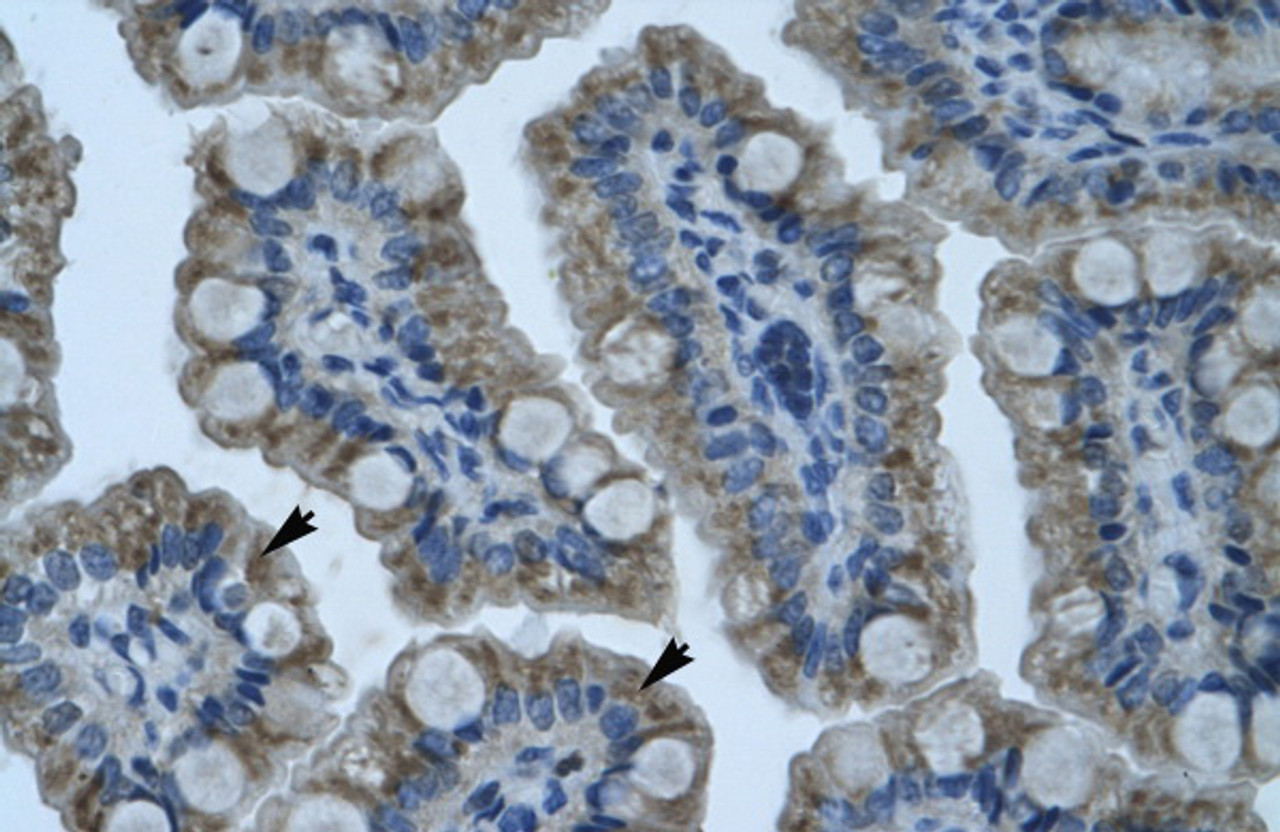 Antibody used in IHC on Human Intestine.