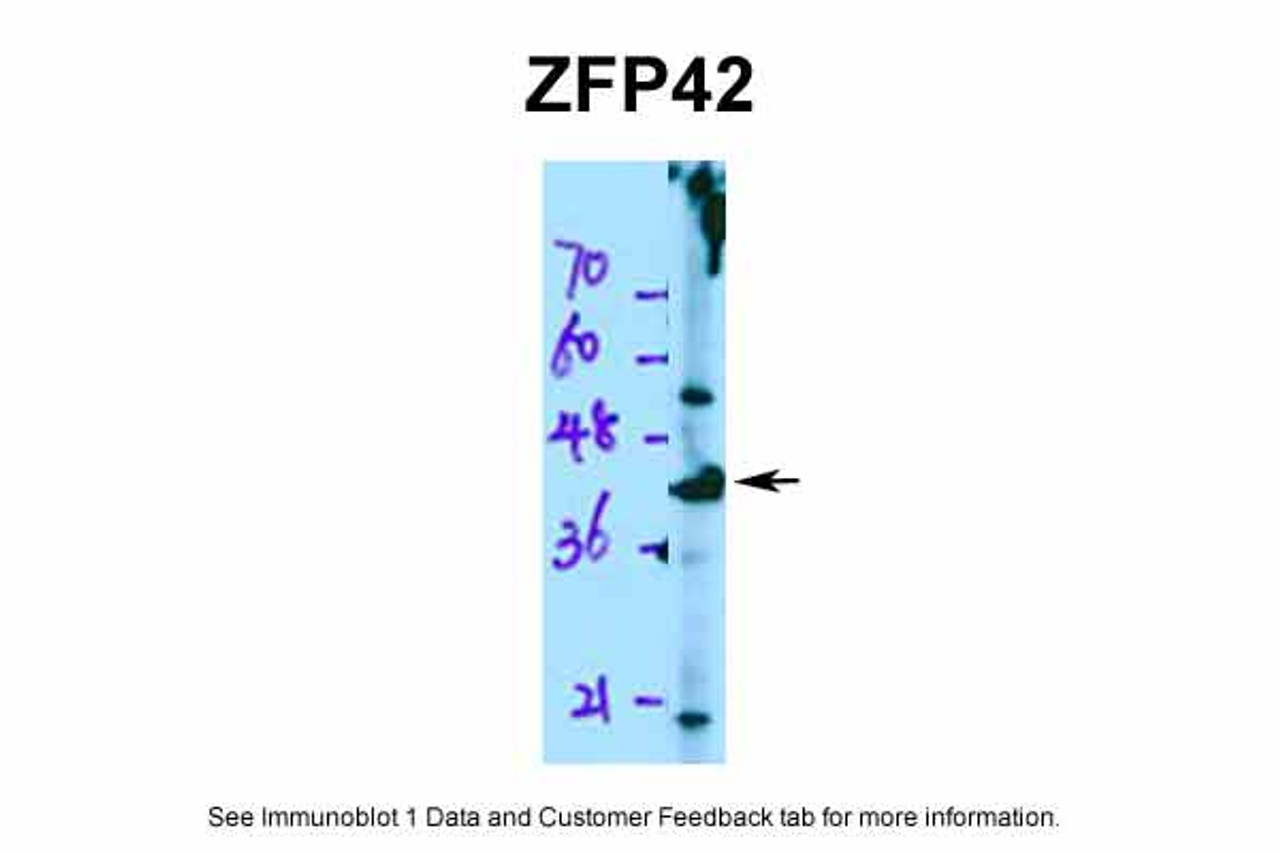 Antibody used in WB on Human Jurkat 0.2-1 ug/ml.