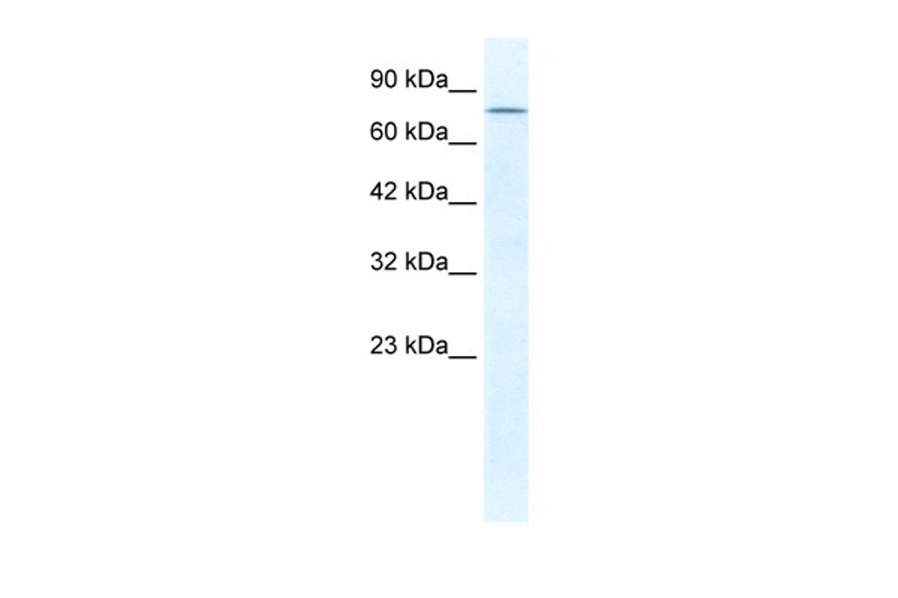 Antibody used in WB on Human HepG2 cells at 1.25 ug/ml.