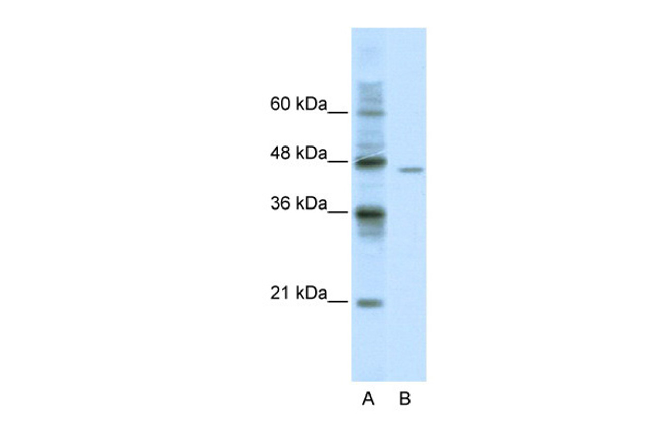 Antibody used in WB on Human Jurkat 0.2-1 ug/ml.