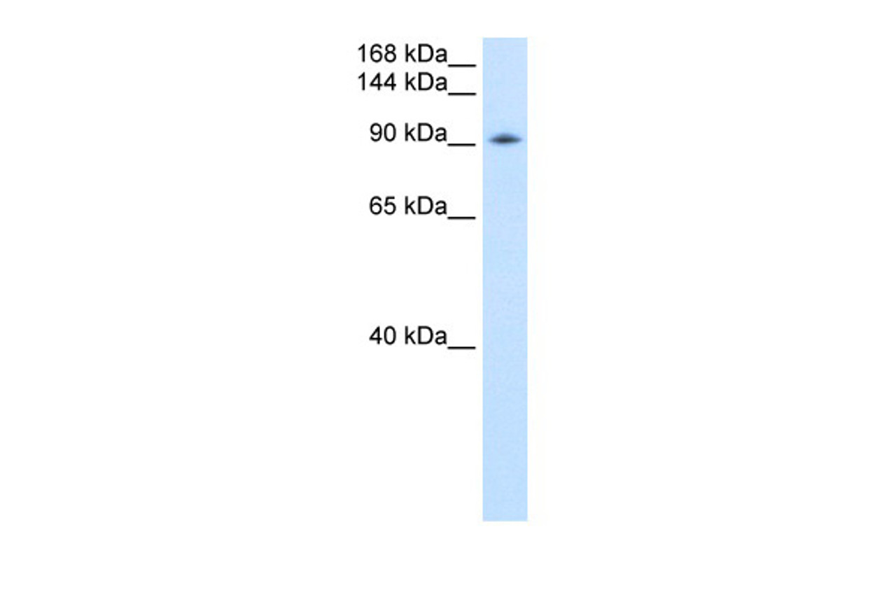 Antibody used in WB on Transfected 293T at 0.2-1 ug/ml.