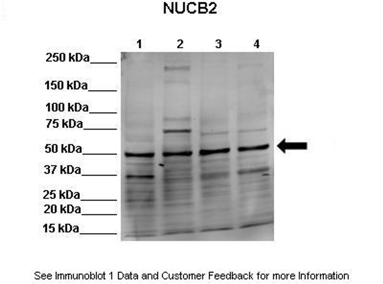 Antibody used in WB on Human, canine, Mouse at: 1:1000 (Lane 1: 50ug HEK293 lysate, Lane 2: 50ug MDCK lysate, Lane 3: 50ug NMuMG lysate, Lane 4: 50ug MDAMB231 lysate) .