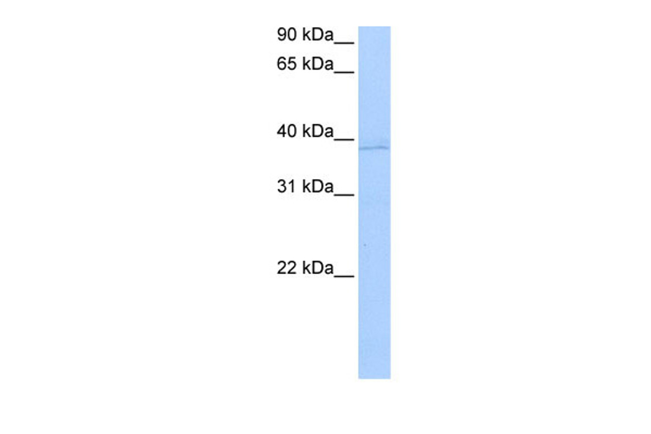 Antibody used in WB on Human MCF-7 at 0.2-1 ug/ml.