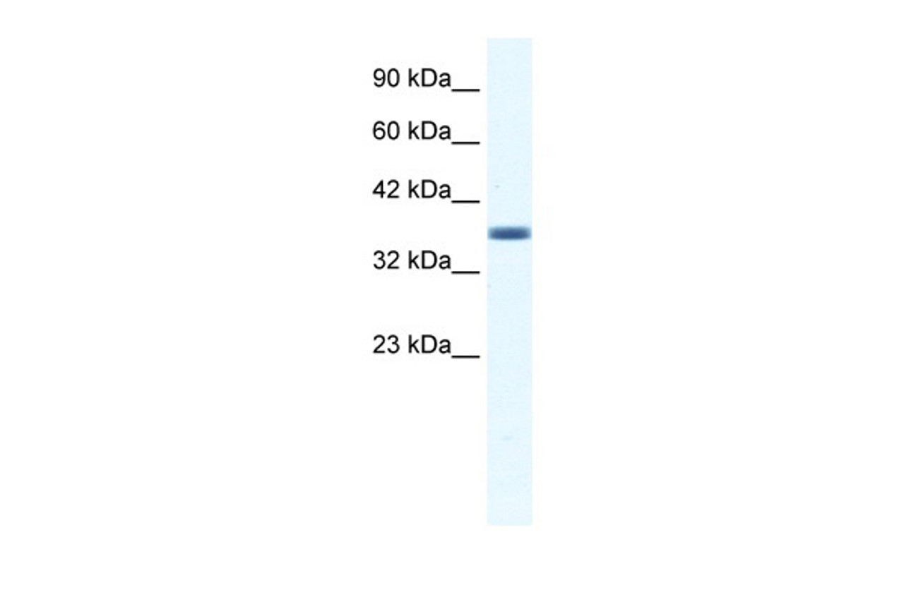 Antibody used in WB on Human HepG2 at 1.25 ug/ml.