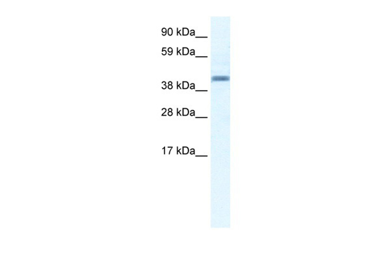 Antibody used in WB on Human Placenta at 2.5 ug/ml.