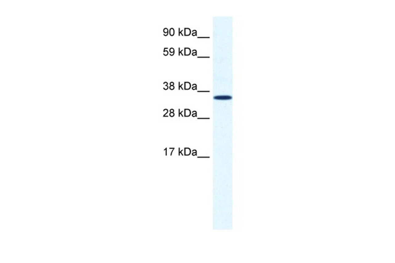 Antibody used in WB on Human Lung at 1.25 ug/ml.