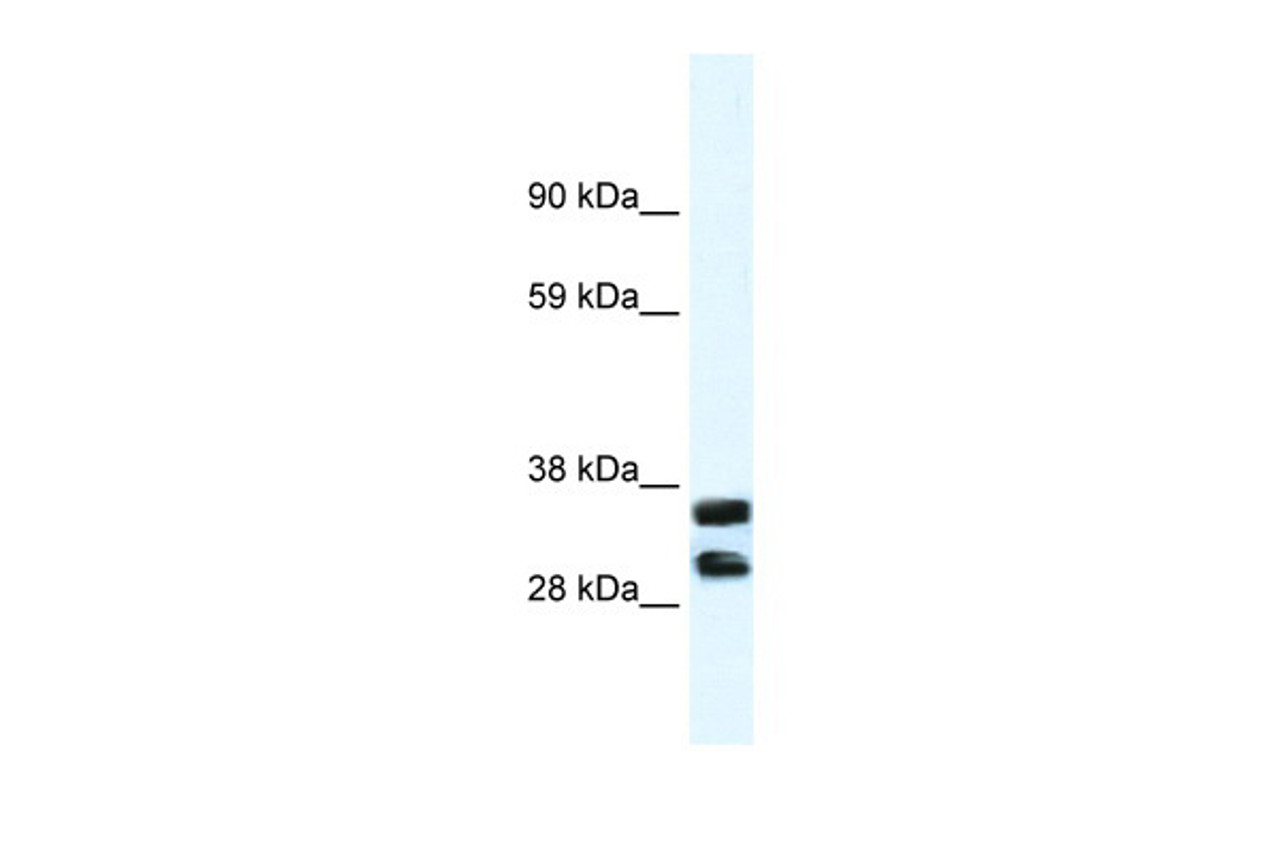 Antibody used in WB on Human Small Intestine at 1.25 ug/ml.