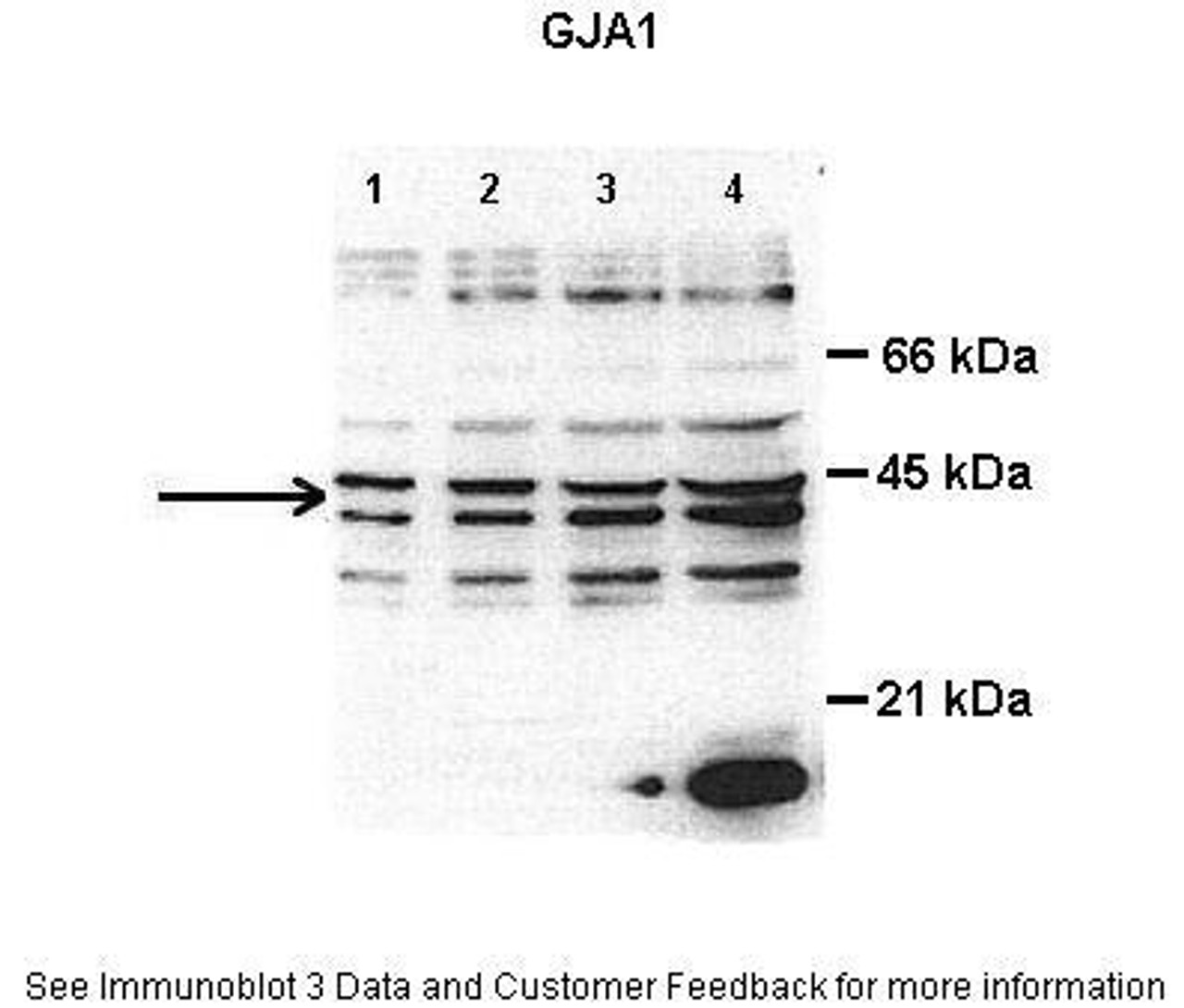 Antibody used in WB on Rat cardiac at 0.25 ug/ml (Lane1: 8 ug total cardiac lysate, Lane2: 15 ug total cardiac lysate, Lane3: 30 ug total cardiac lysate, Lane4: 50 ug total cardiac lysate) .