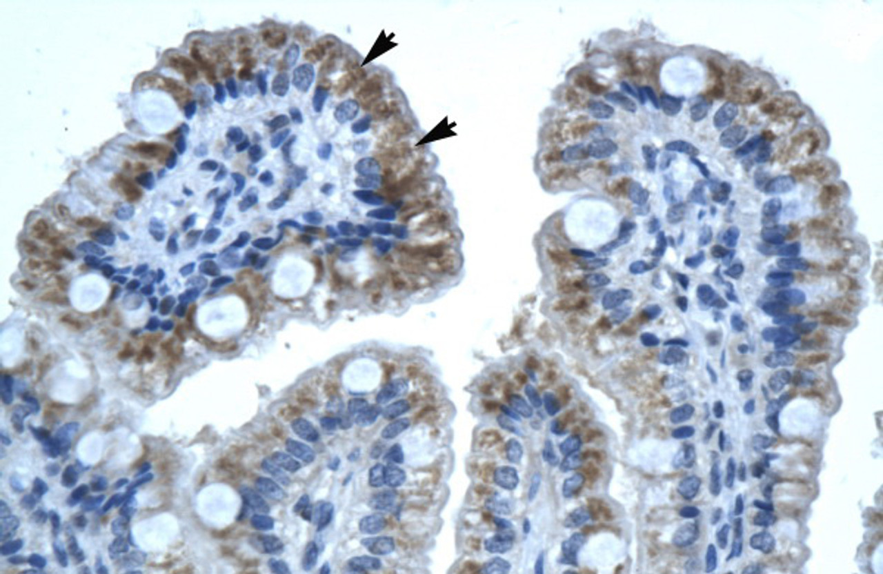 Antibody used in IHC on Human Intestine.