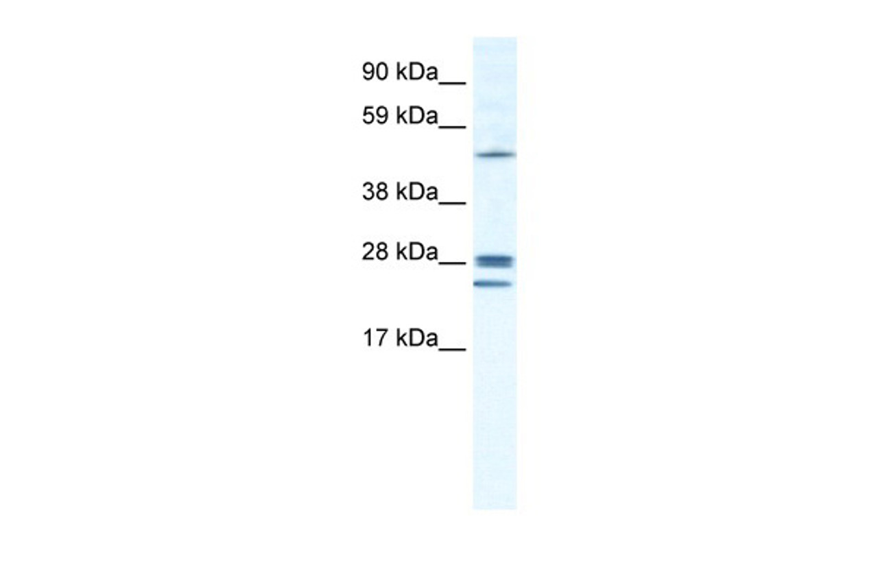 Antibody used in WB on Human Lung at 1.25 ug/ml.