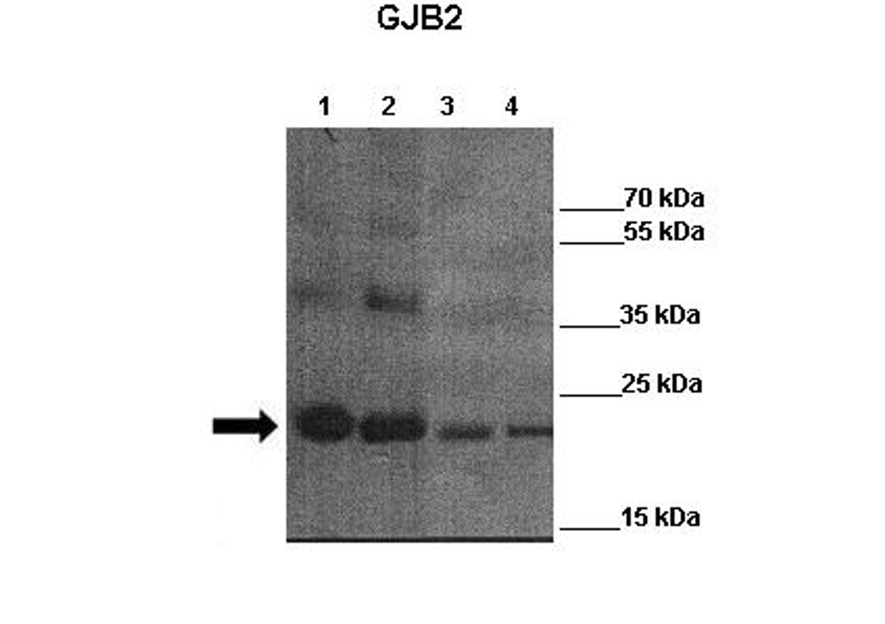 Antibody used in WB on Lane 1: 4ug mCx26 elution fraction 6 Lane 2: 4ug mCx26 elution fraction 7Lane 3: 4ug mCx26 elution fraction 6 + other Cx26 antibody Lane 4: 4ug mCx26 elution fraction 7 + other Cx26 antibody at 1:3000 (Lane 1: 4ug mCx26 elution fraction 6 Lane 2: 4ug mCx26 elution fraction 7Lane 3: 4ug mCx26 elution fraction 6 + other Cx26 antibody Lane 4: 4ug mCx26 elution fraction 7 + other Cx26 antibody ) .