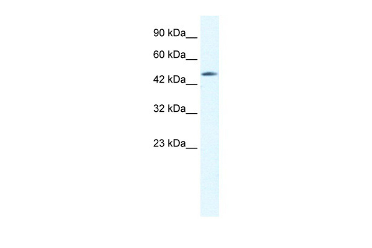 Antibody used in WB on Human HepG2 at 0.6 ug/ml.