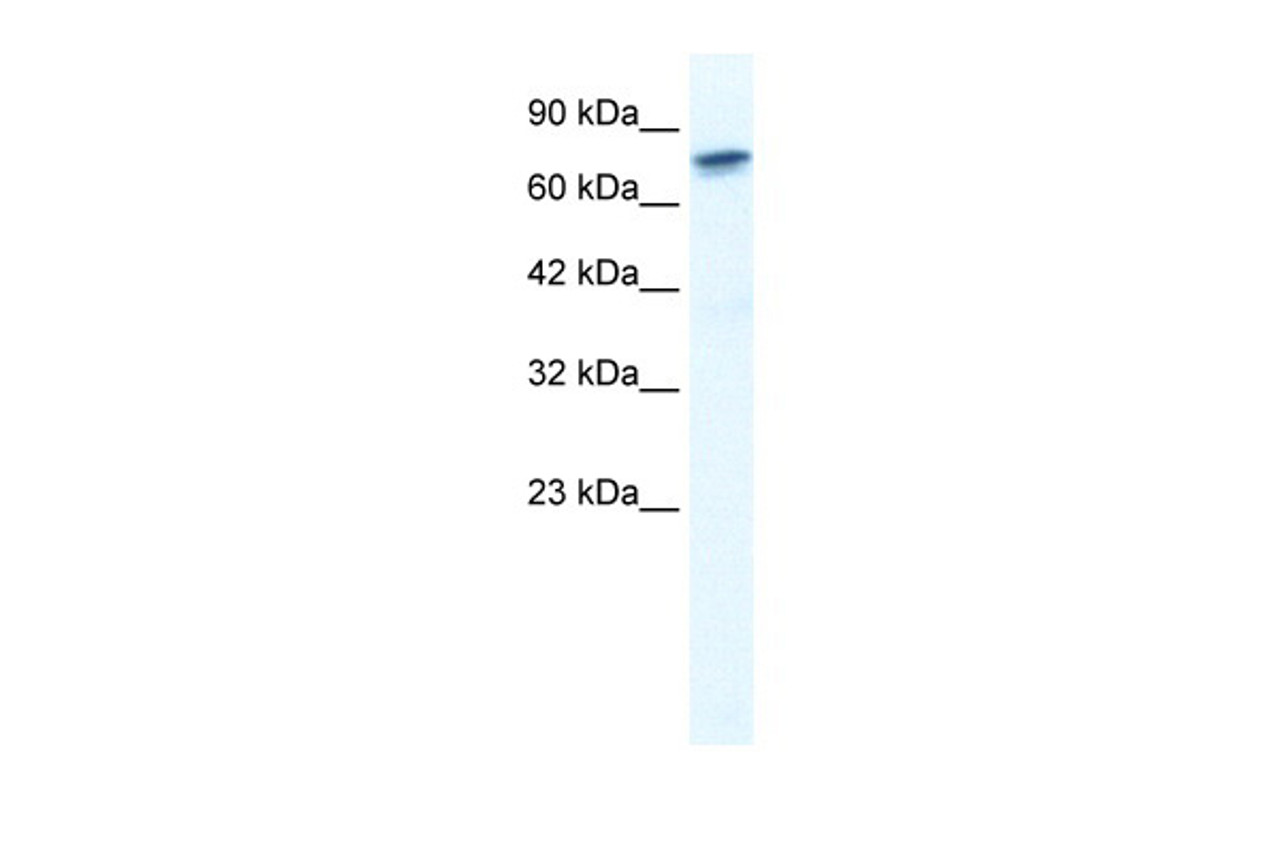 Antibody used in WB on Human HepG2 at 1.25 ug/ml.