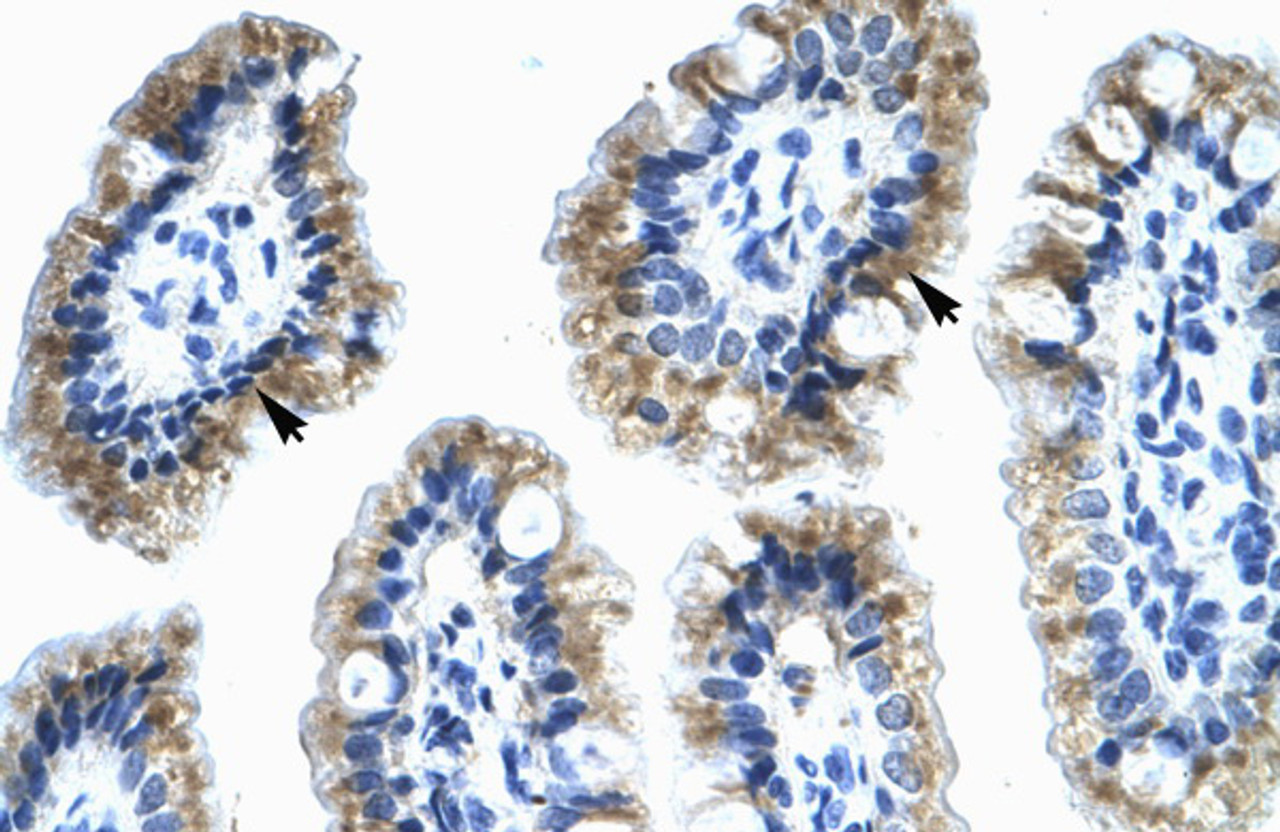 Antibody used in IHC on Human Intestine.