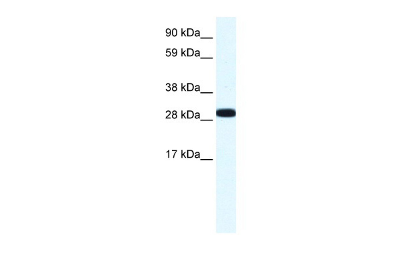 Antibody used in WB on Human Placenta at 1.25 ug/ml.