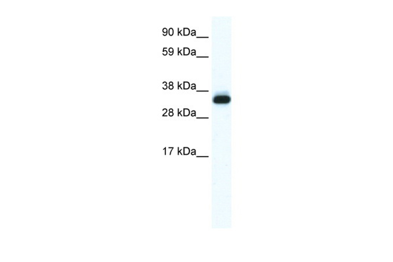 Antibody used in WB on Human Placenta at 0.625 ug/ml.