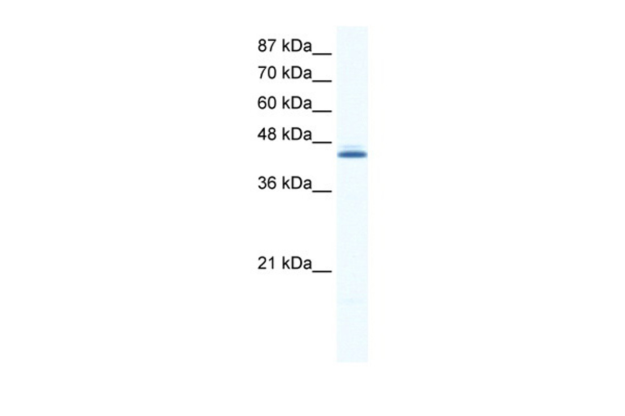 Antibody used in WB on Human HepG2 at 0.2-1 ug/ml.